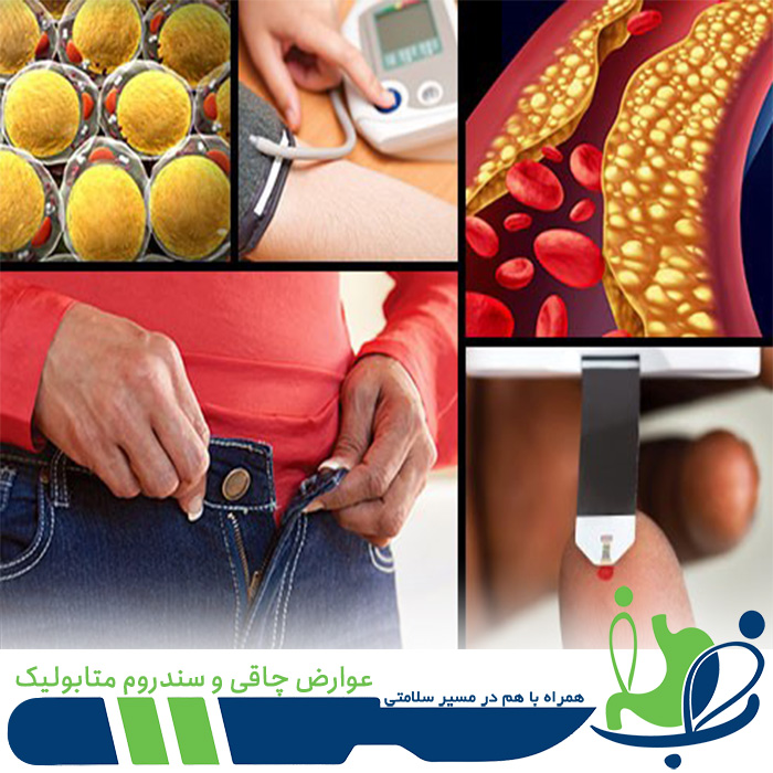 عوارض چاقی و سندروم متابولیک - دکتر شهاب شهابی - چاقی باعث کاهش طول عمر