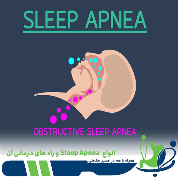 انواع  Sleep Apnea و راه های درمانی آن