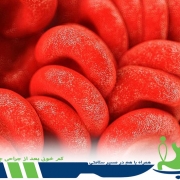 کم خونی بعد از جراحی چاقی