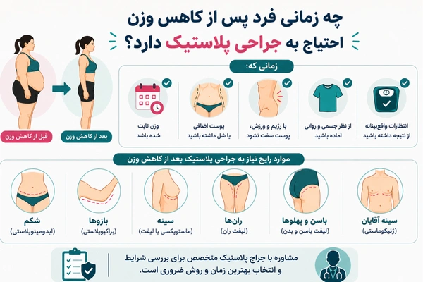 چه زمانی فرد پس از کاهش وزن احتیاج به جراحی پلاستیک دارد؟